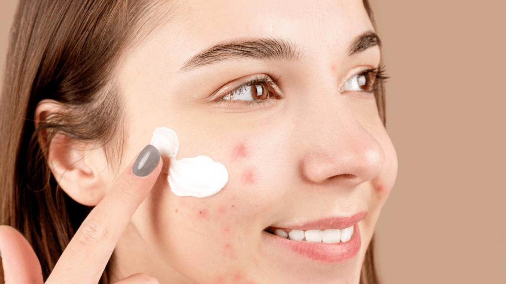 Woman having acne